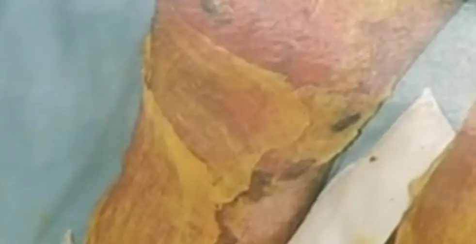 面包房行动下载_逆向坍塌：面包房行动_面包房起火